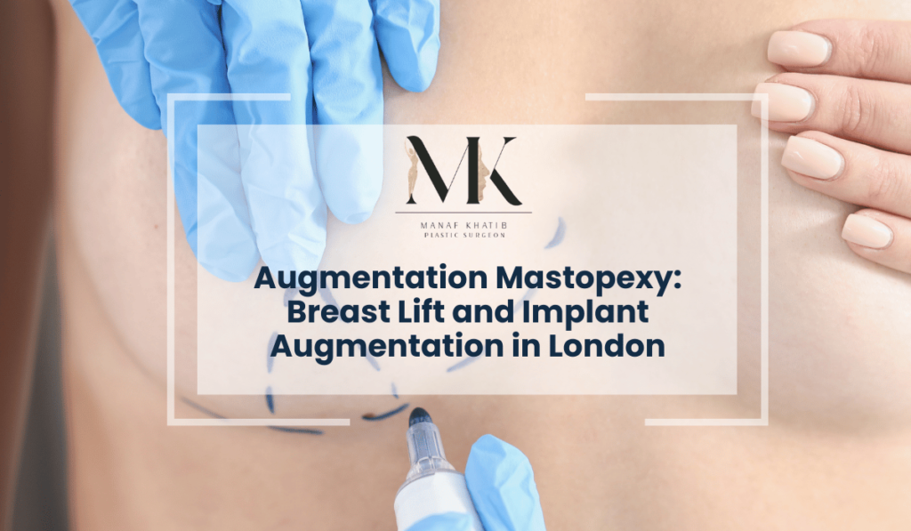 Augmentation Mastopexy london image