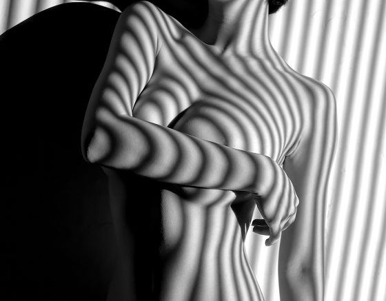 Excessive Sweating “Hyperhidrosis”