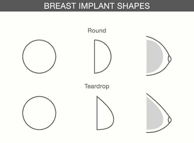 Different Breast Implant Types | Choosing Between Round & Teardrop Implants For Breast Augmentation & Enhancement | London Plastic Surgeon | MK Plastic Surgery