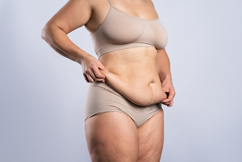 How To Remove Loose Skin After Weight Loss | Excess Stomach, Arm, or Breast Skin Removal | Cosmetic Surgeon London | MK Plastic Surgery