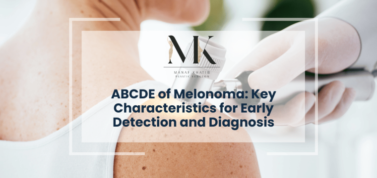 ABCDE of Melonoma london
