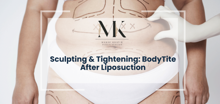 BodyTite After Liposuction london