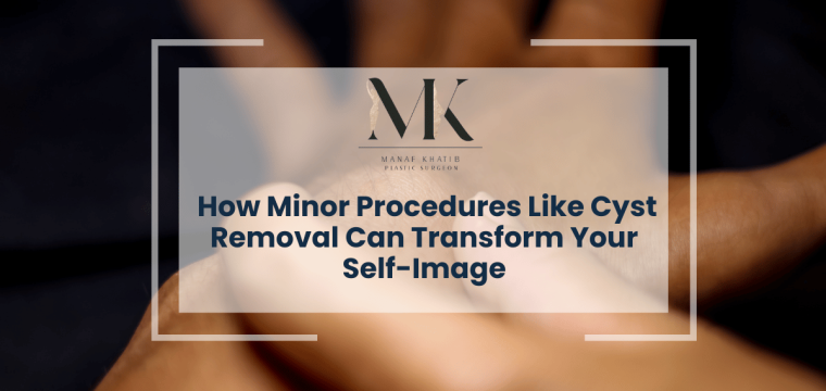 Cyst Removal london