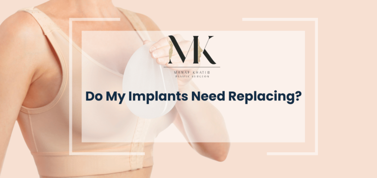 Do My Implants Need Replacing london