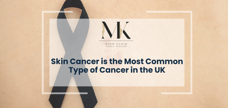 Manaf Khatib skin cancer london uk