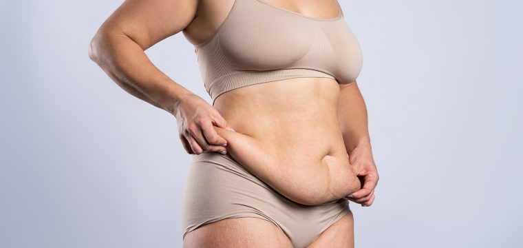 How To Get Rid Of Apron Belly Permanently | What Works | Reducing Apron Belly After Pregnancy Or Weight Loss | Expert Plastic Surgon London | MK Plastic Surgery